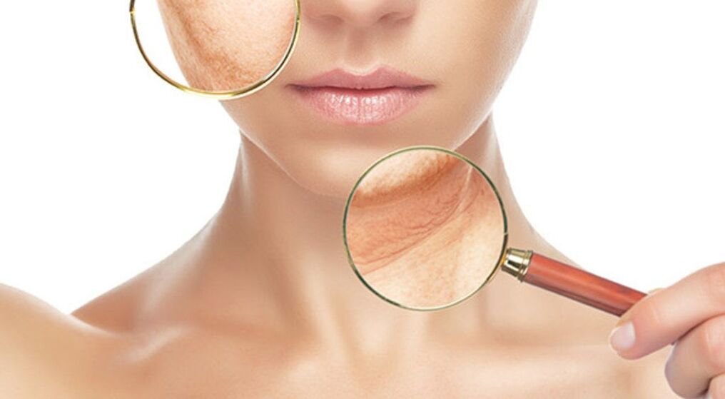 Laser treatment can effectively eliminate wrinkles